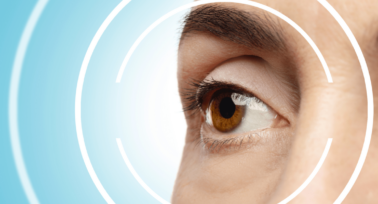 Why you should consider laser eye surgery at the time of corneal collagen cross linking for keratoconus