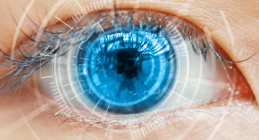 iDesign Lasik (laser eye surgery) – is it the best