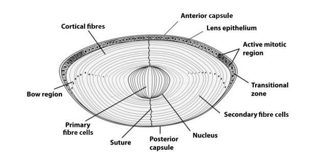 different types of cataract