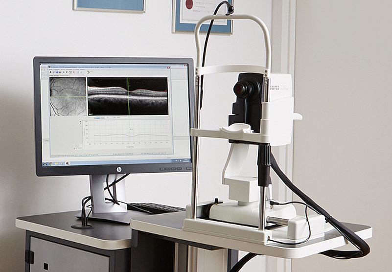 optical coherence tomography scan glaucoma